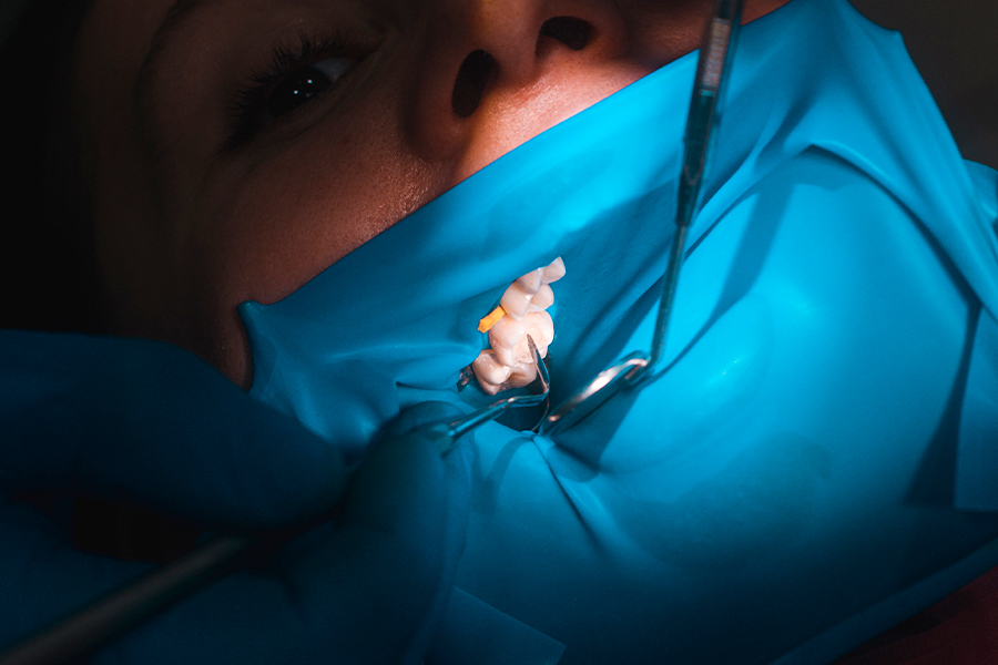 根管治療の流れと
治療期間について