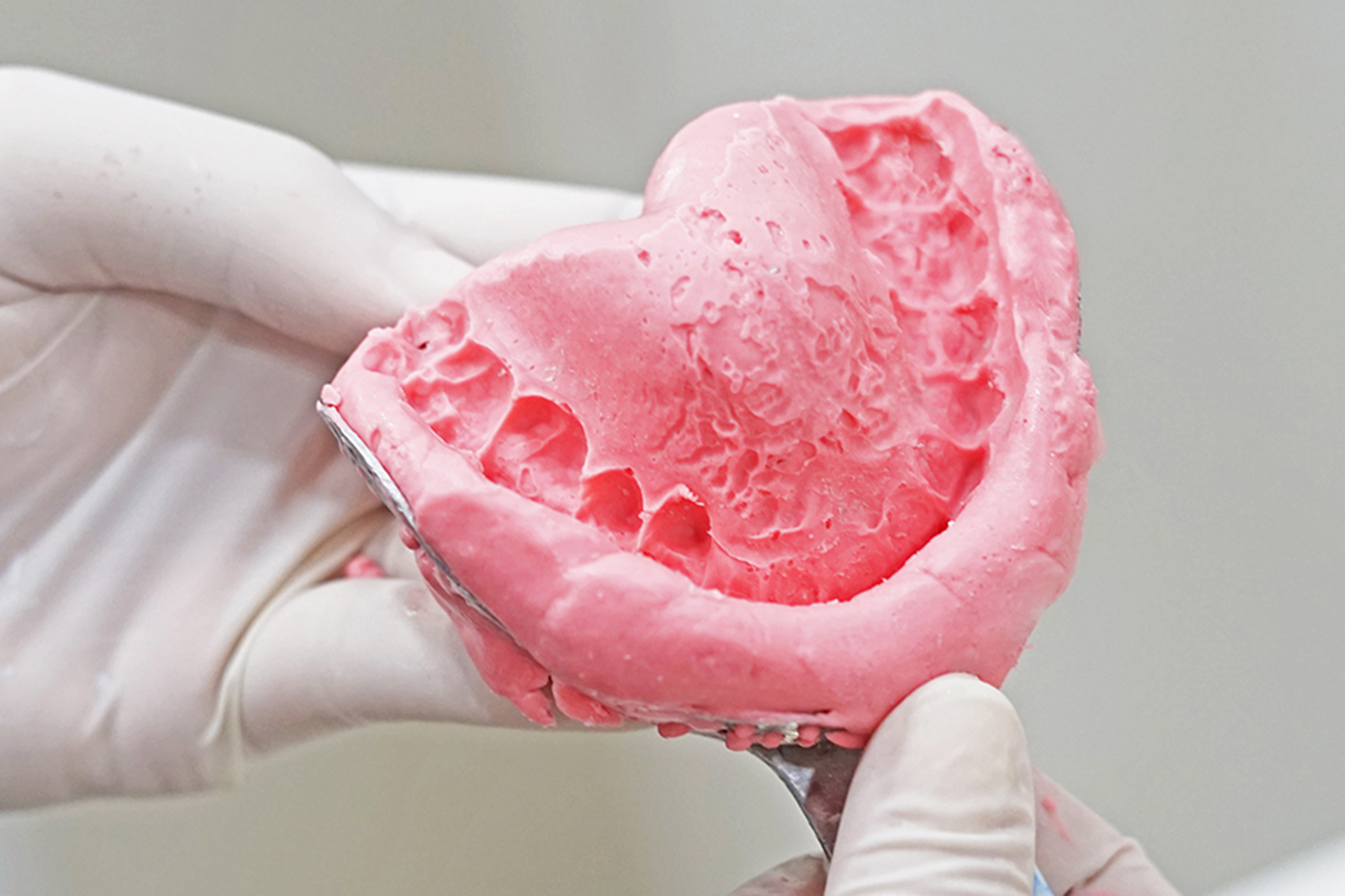 前処置・型取り