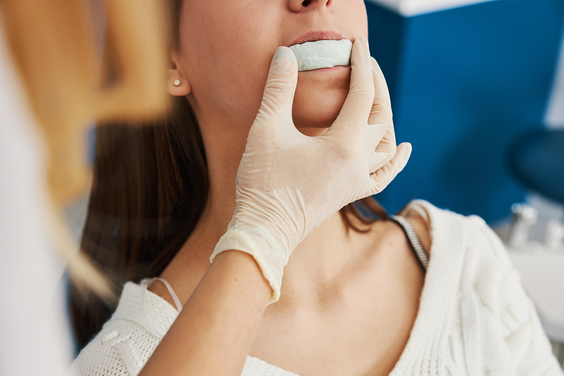 嚙み合わせ等の記録