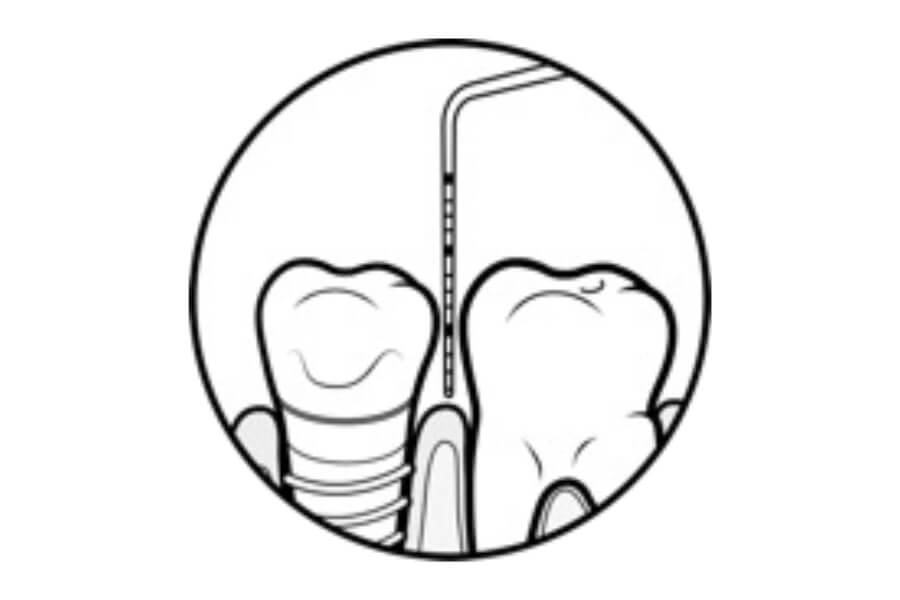 評価と感染予防